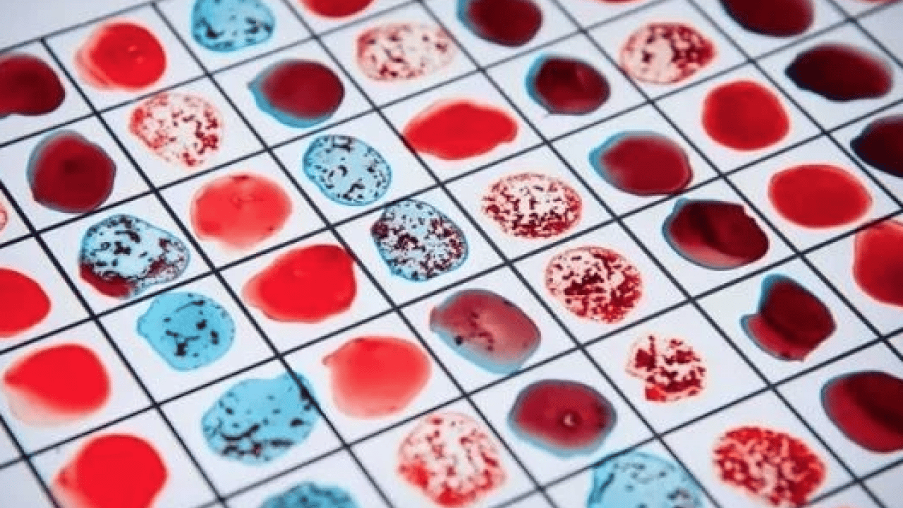 Foto - A Grubu mu, B mi, AB mi, O mı? Kan grubun karakterini açıklıyor