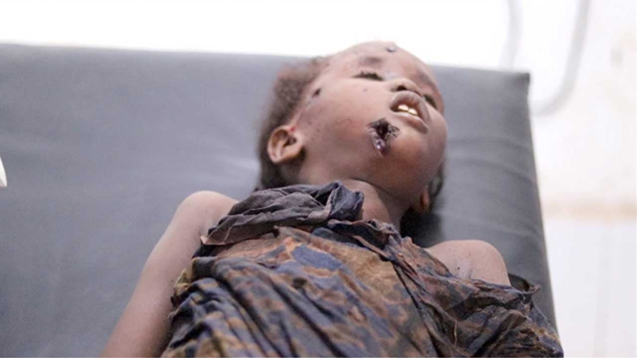 Foto - ABD, İslam ülkesinde sivil katliamı yaptı!