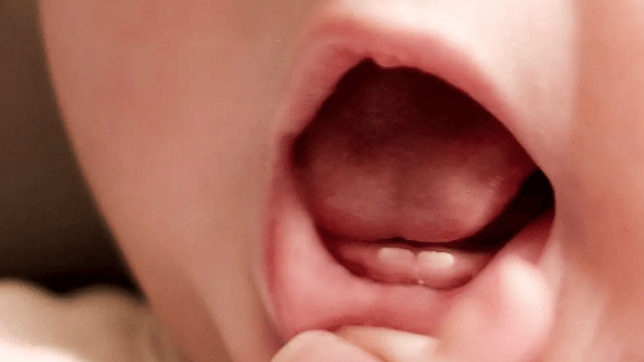 Foto - Yenidoğan bebekte diş görünürse dikkat! Bebeklerde bu sorun olmaya başladı