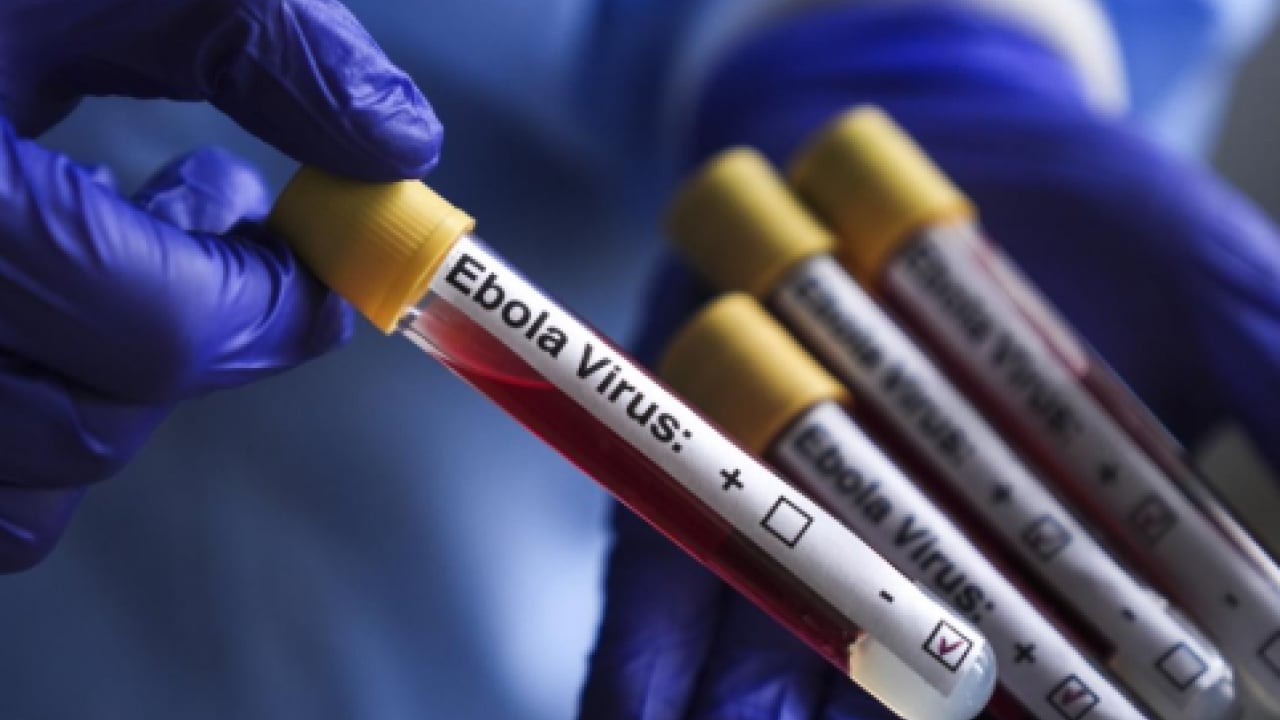 Foto - Afrika’da dehşet sinyali! Ebola taşıyan 300 kişi kayıp
