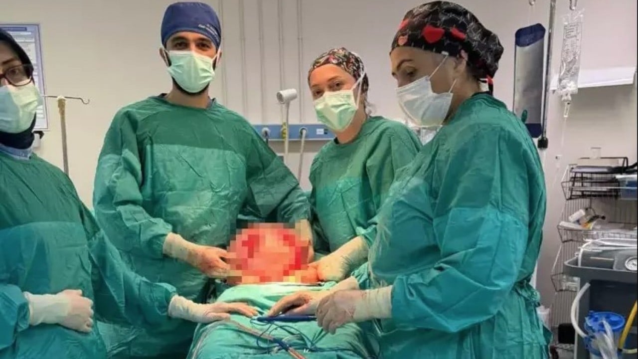  "Ağrım var" diye hastaneye gitti! Karnından 8,5 kiloluk kitle çıktı