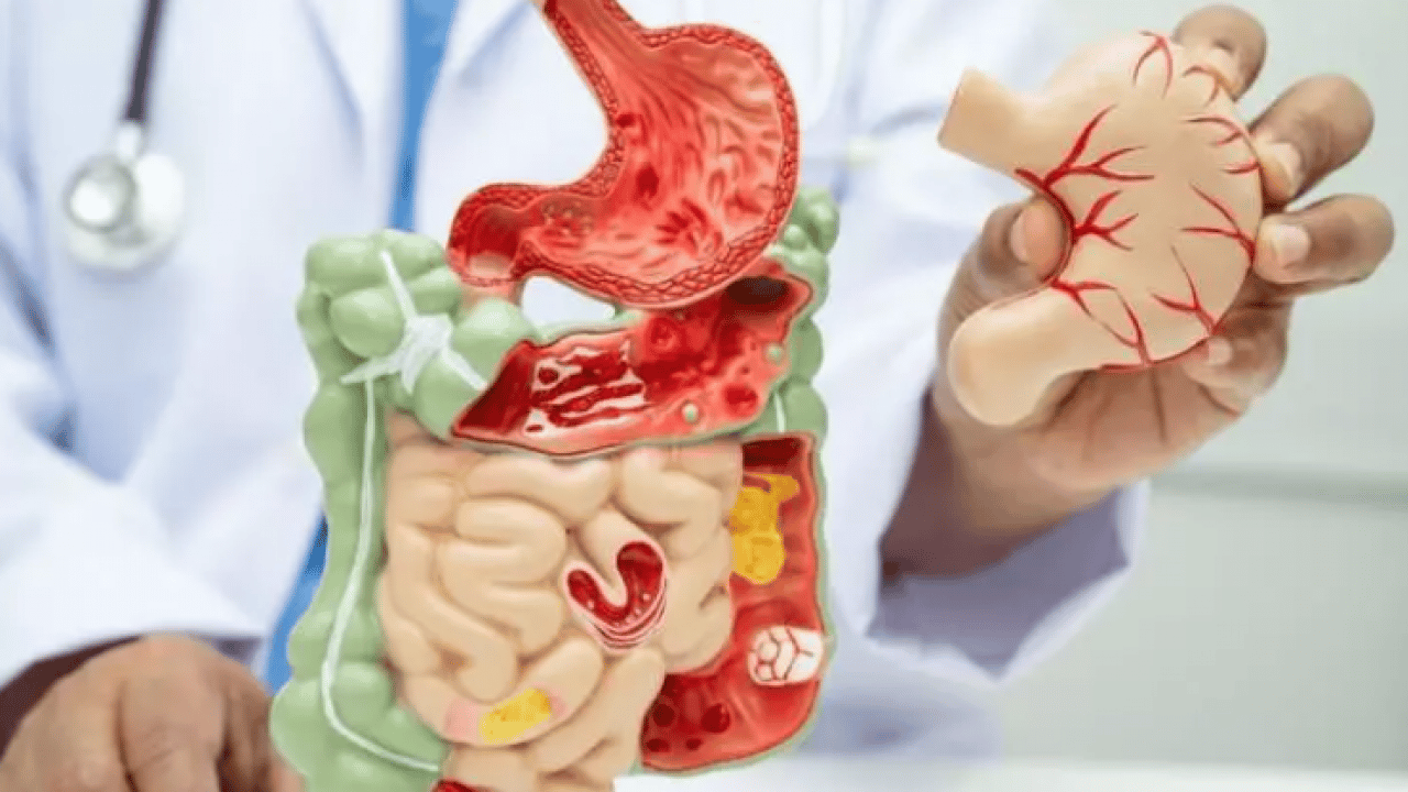 Foto - Bu besinleri ağzınıza bile sürmeyin! Meğer bağırsakları mahvediyormuş!