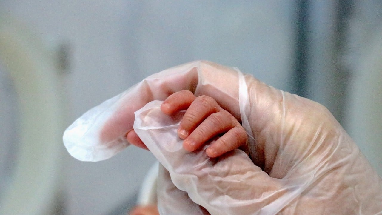 Foto - Aile hayırseverlerden destek bekliyor: Prematüre dördüzler 34 günde hayata tutundu