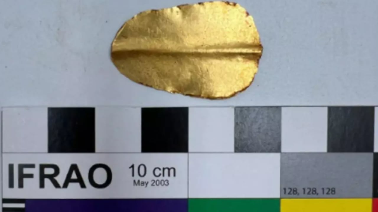 Foto - Ağızlarından altın dil çıktı! Nedeni çok şaşırttı!