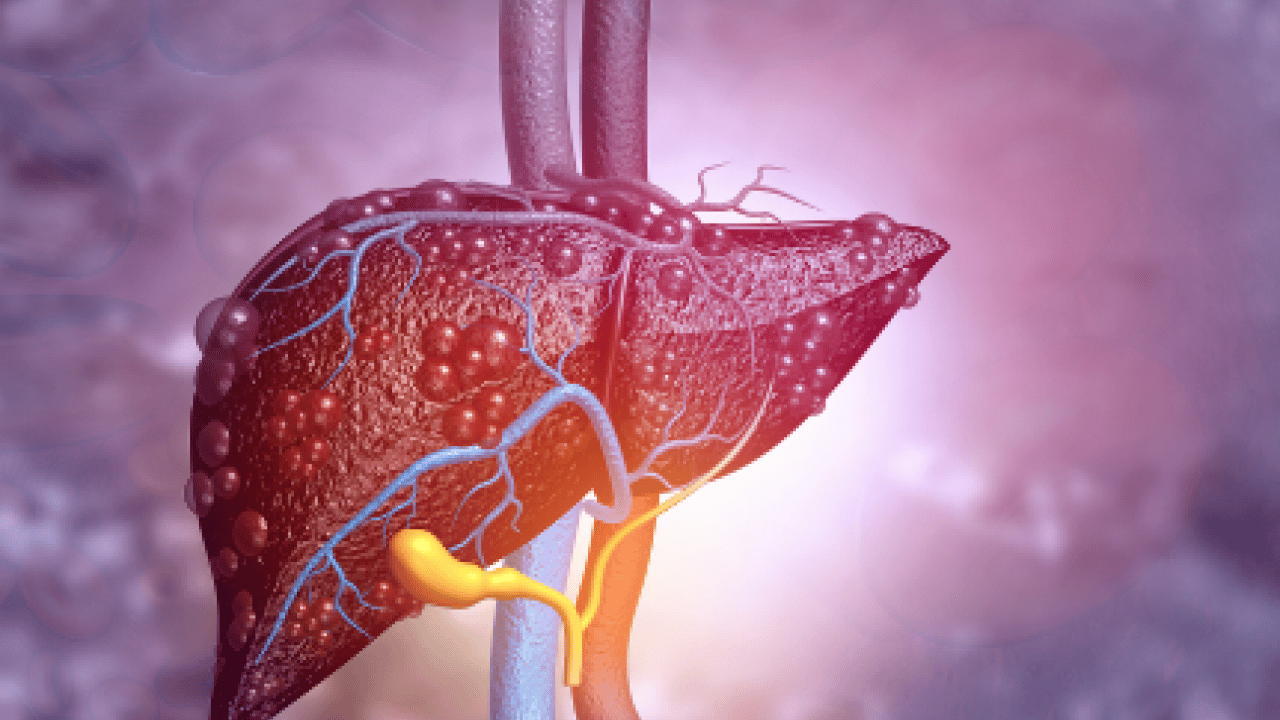 Foto - Alkol, karaciğerin düşmanı: Uzak tutun! Bu şekilde beslenirseniz tedavisi mümkün! İşte o yiyecekler