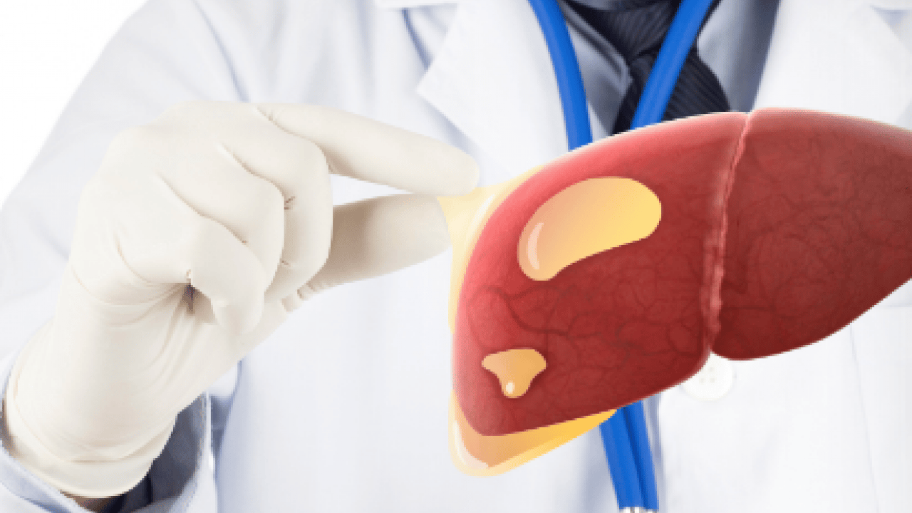 Foto - Alkol, karaciğerin düşmanı: Uzak tutun! Bu şekilde beslenirseniz tedavisi mümkün! İşte o yiyecekler