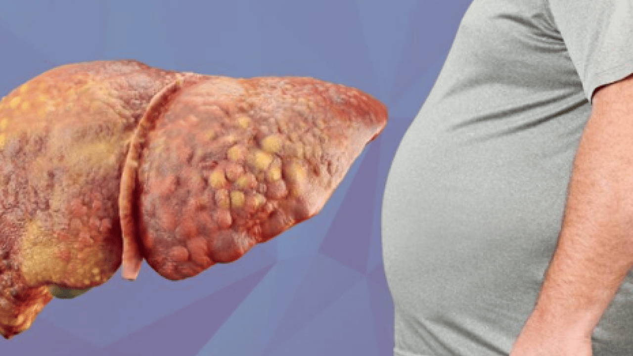 Foto - Alkol, karaciğerin düşmanı: Uzak tutun! Bu şekilde beslenirseniz tedavisi mümkün! İşte o yiyecekler