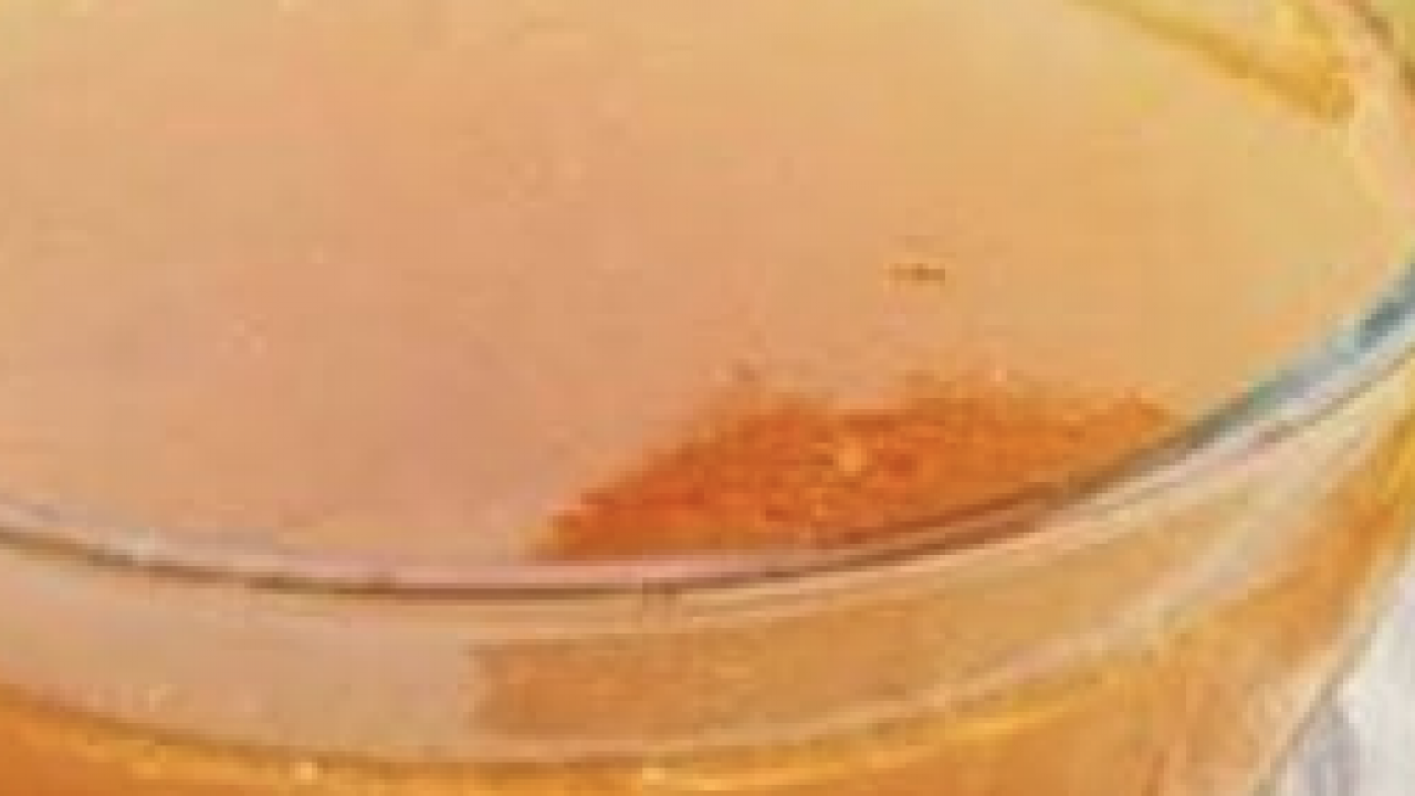 Foto - Altın gibi parlatsın cildinizi! Vücuda protein yayılıyor, kaslar bayram edecek