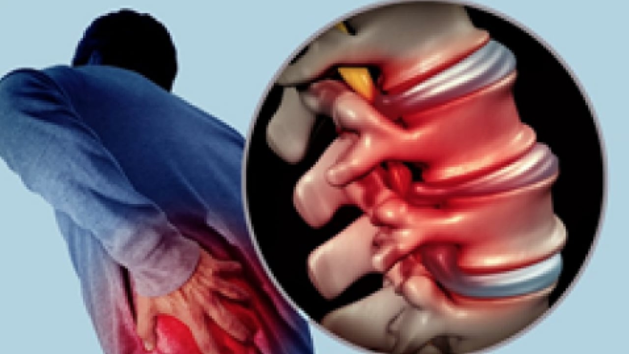 Foto - Altında yatan hastalık sebebi ne olabilir! Geçmeyen bel ağrısı bakın neyin habercisi...