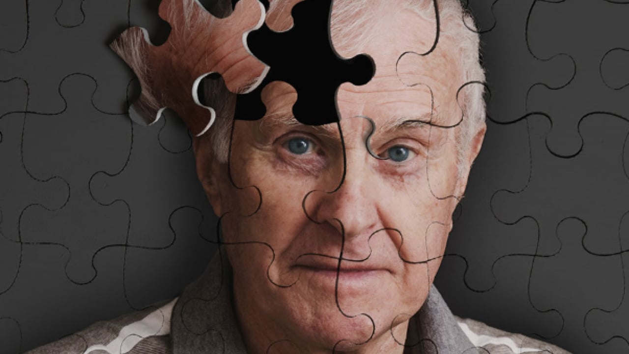 Foto - Alzheimer'la ilgili önemli detayı uzmanlar ortaya çıkardı!