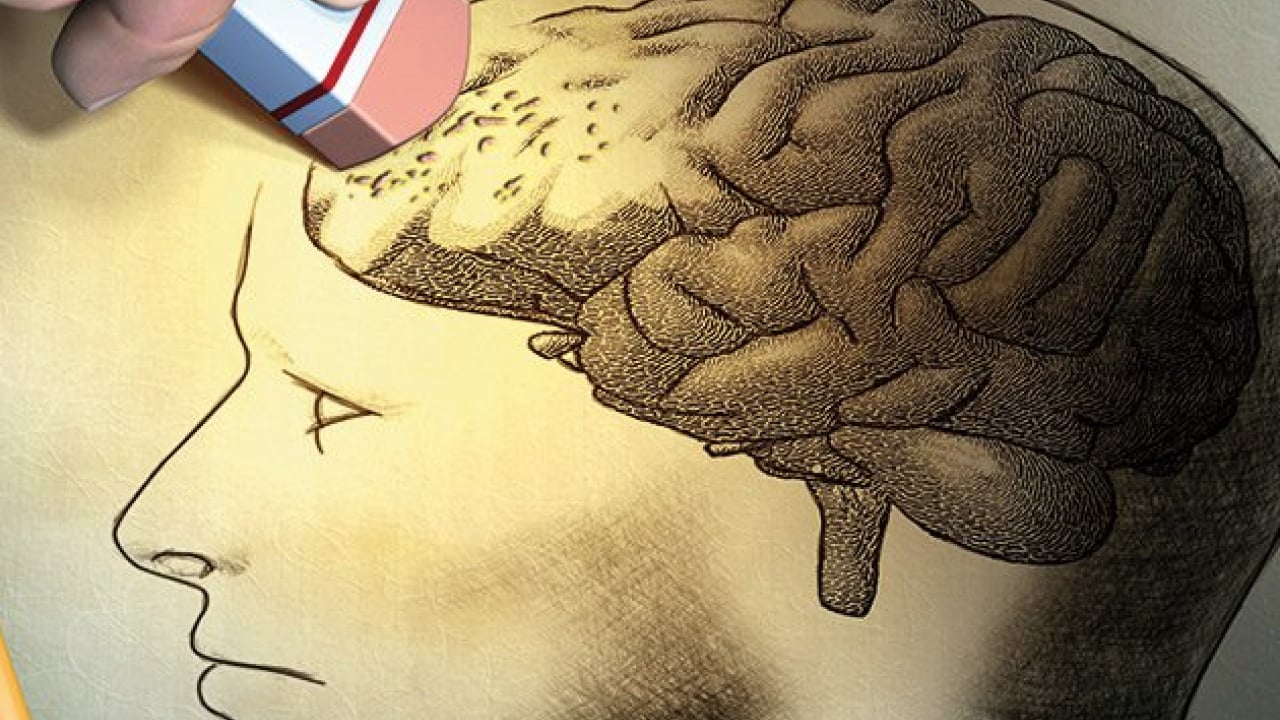 Foto - Alzheimer'la ilgili önemli detayı uzmanlar ortaya çıkardı!