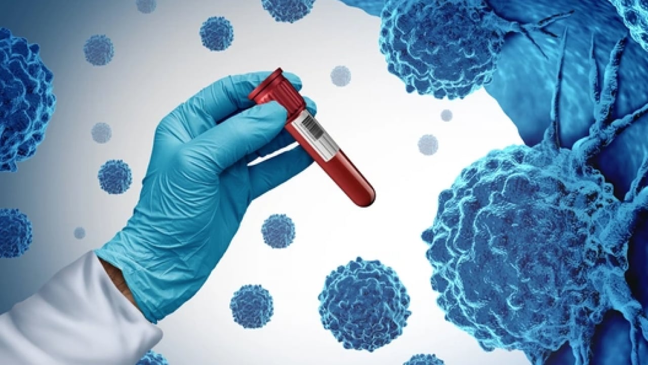 Foto - Aman dikkat artık: Uzmanlar uyarıyor: Kanserlerin bir kısmı değiştirilebilir risk...