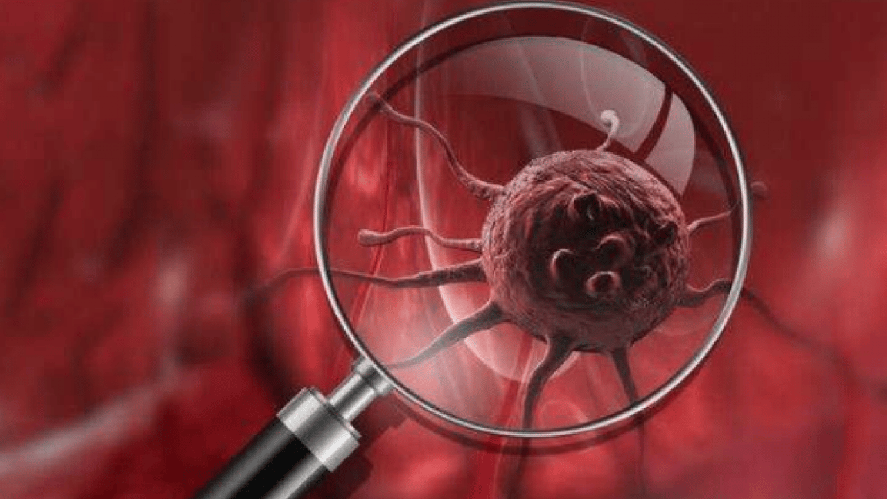 Foto - Aman dikkat artık: Uzmanlar uyarıyor: Kanserlerin bir kısmı değiştirilebilir risk...