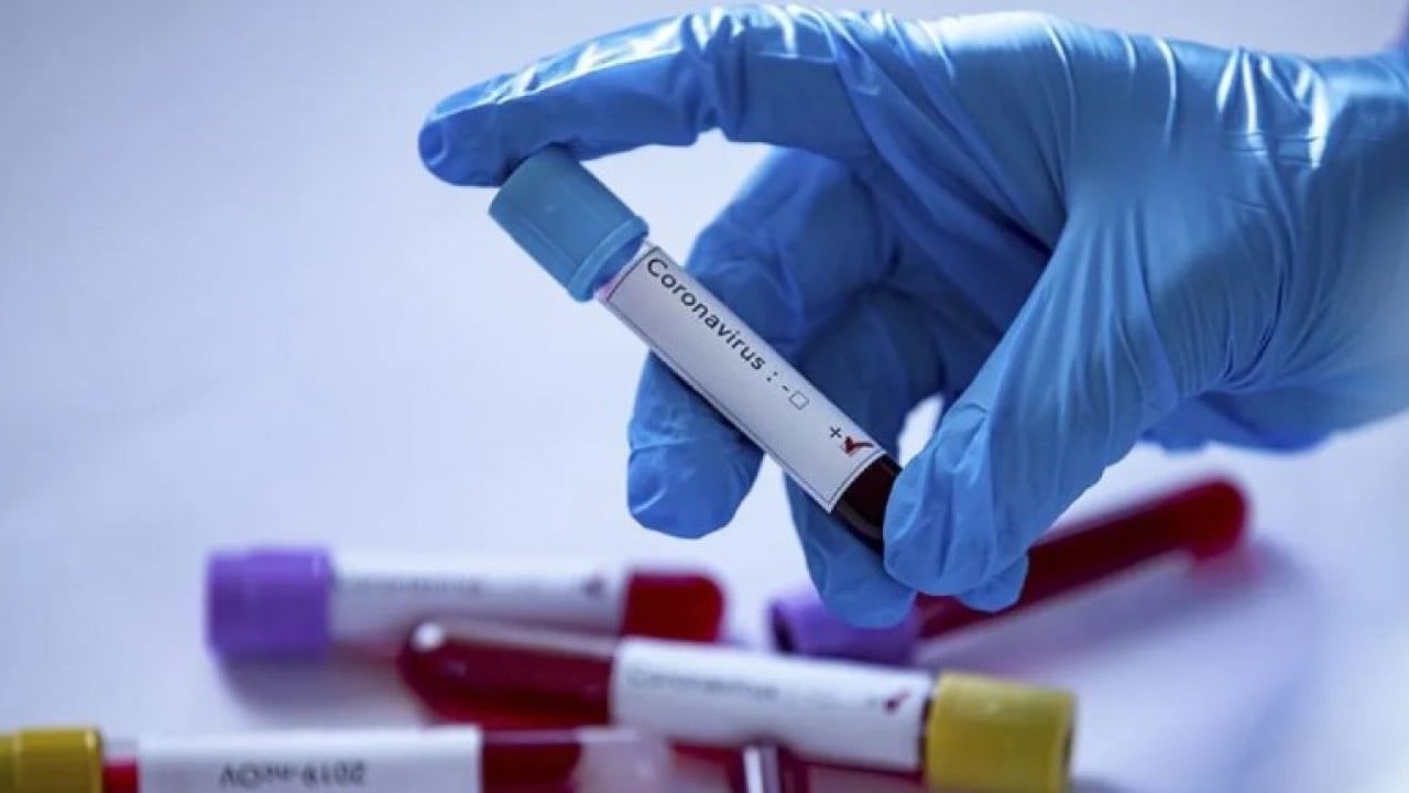 Foto - Anksiyeteden kalp çarpıntısına: Meğer fazlasının zararı çokmuş!