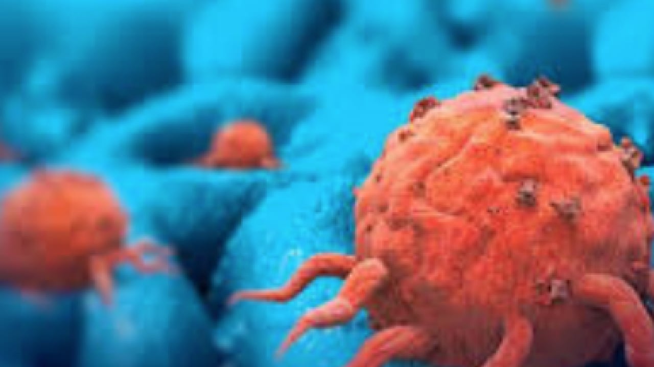 Foto - Araştırma Hastanesi doktoru tek tek anlattı... Her 10 kadından 1'inde endometriozis görülüyor