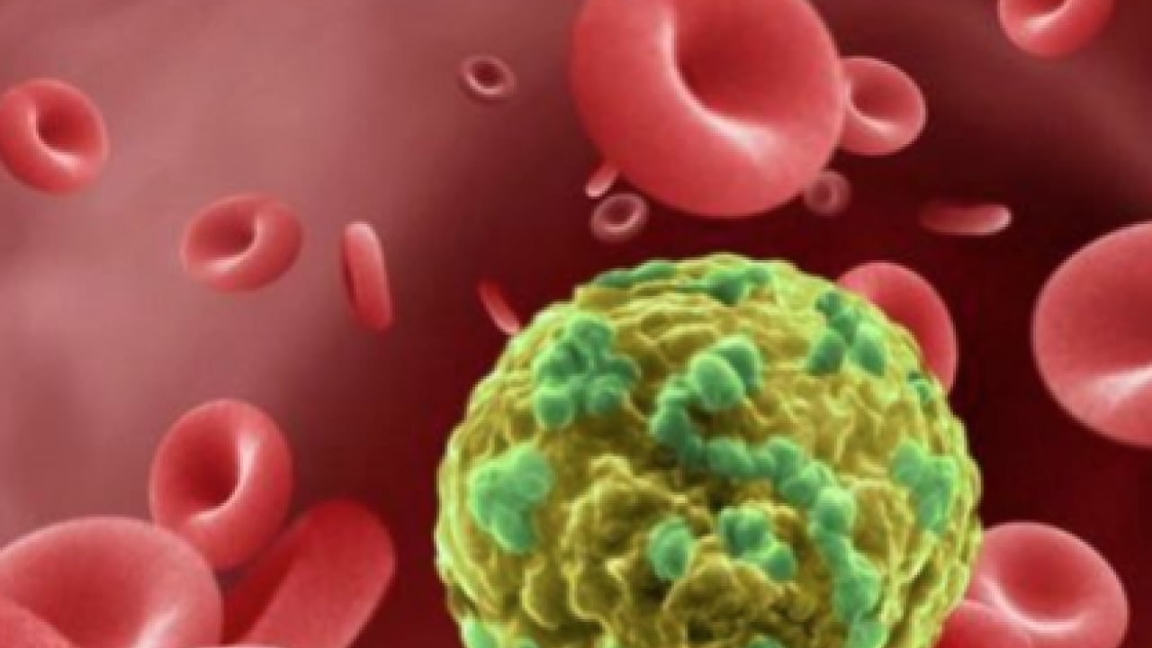 Foto - Araştırma Hastanesi doktoru tek tek anlattı... Her 10 kadından 1'inde endometriozis görülüyor