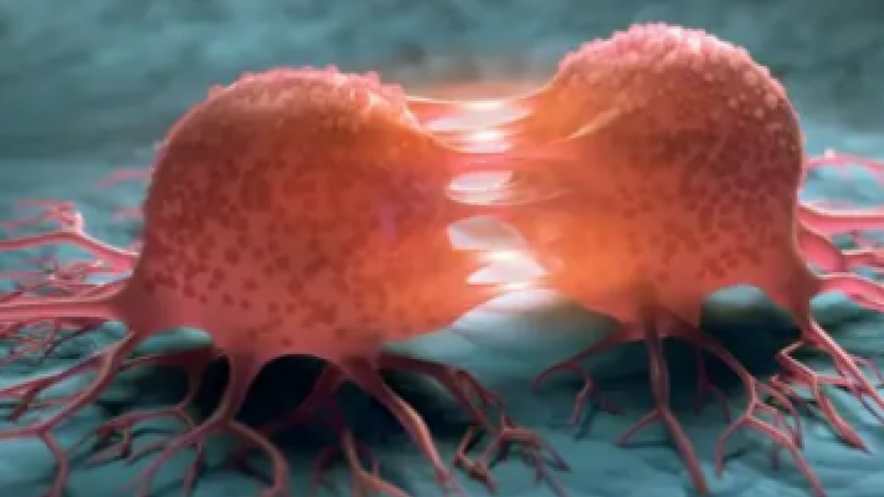 Foto - Araştırma Hastanesi doktoru tek tek anlattı... Her 10 kadından 1'inde endometriozis görülüyor