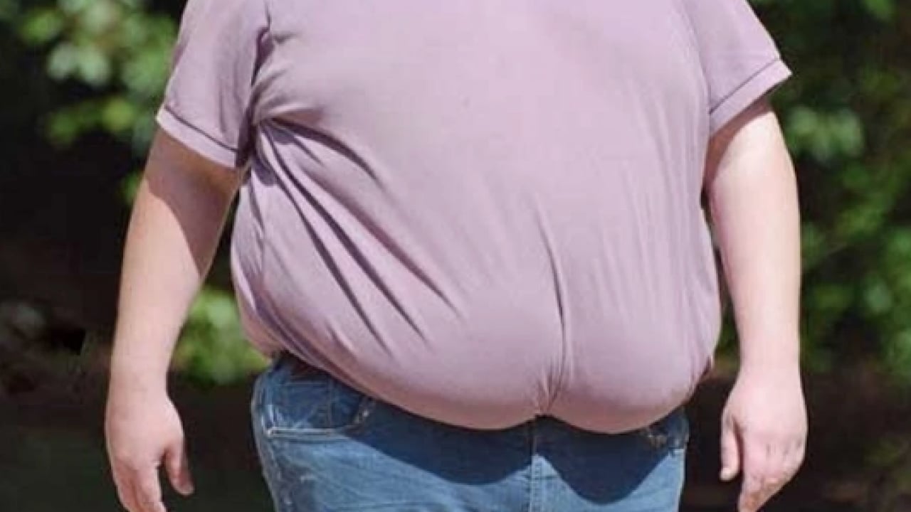 Foto - Artık Cerrahi müdahale için çare olabilir: Obezite tedavisinde yönetmelik Resmi Gazete'de yayımlandı