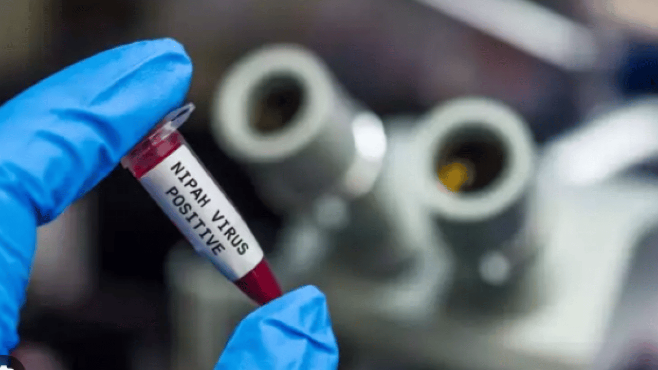 Foto - Nipah virüsünün tedavisi yok: Ölüm oranı yüzde 70'lerde!