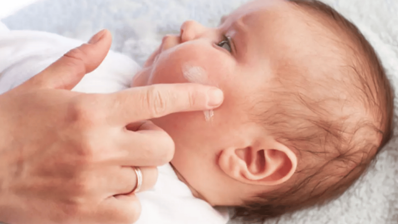 Foto - Atopik dermatit vakaları... Egzaması olan bebekler için ciddi önlem alınmalı...