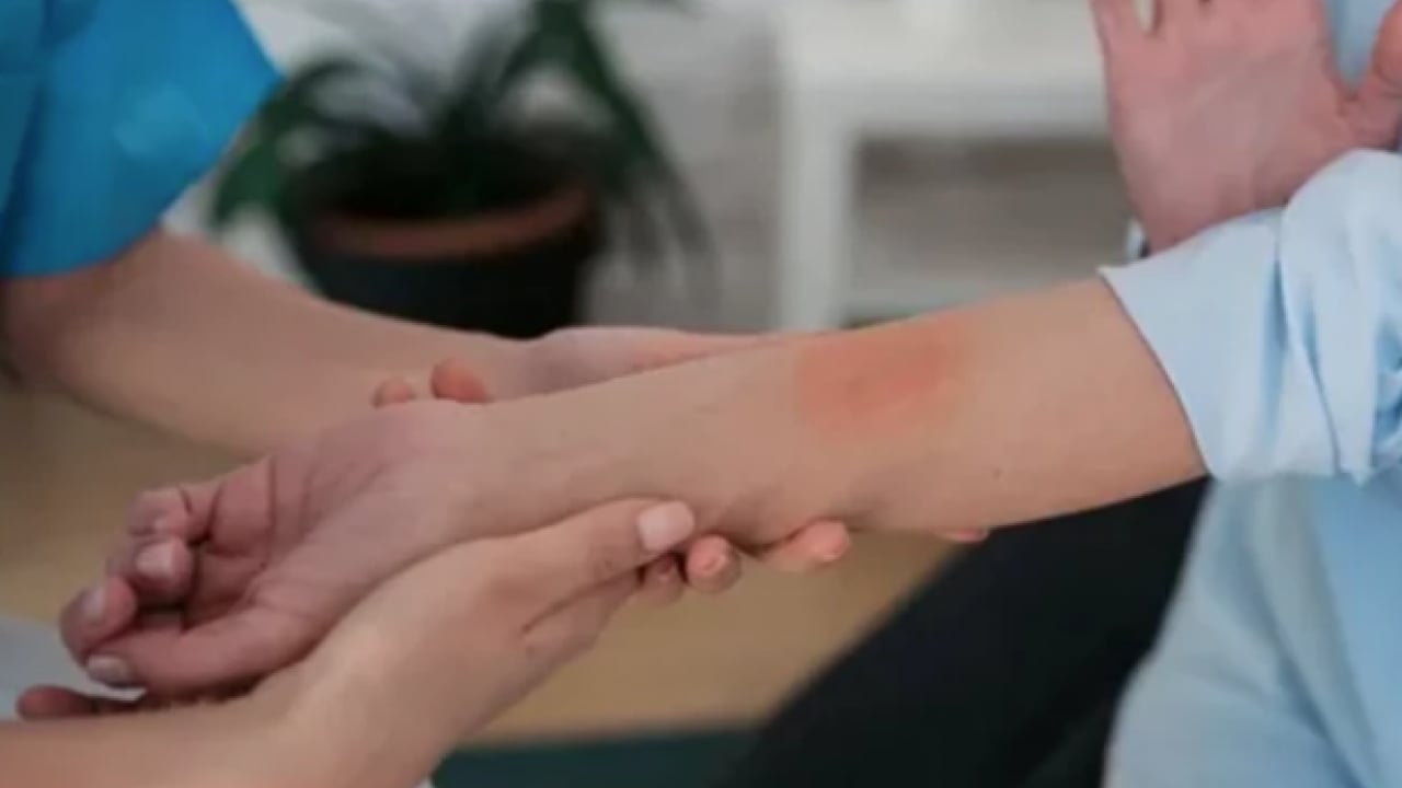 Foto - Atopik dermatit vakaları... Egzaması olan bebekler için ciddi önlem alınmalı...