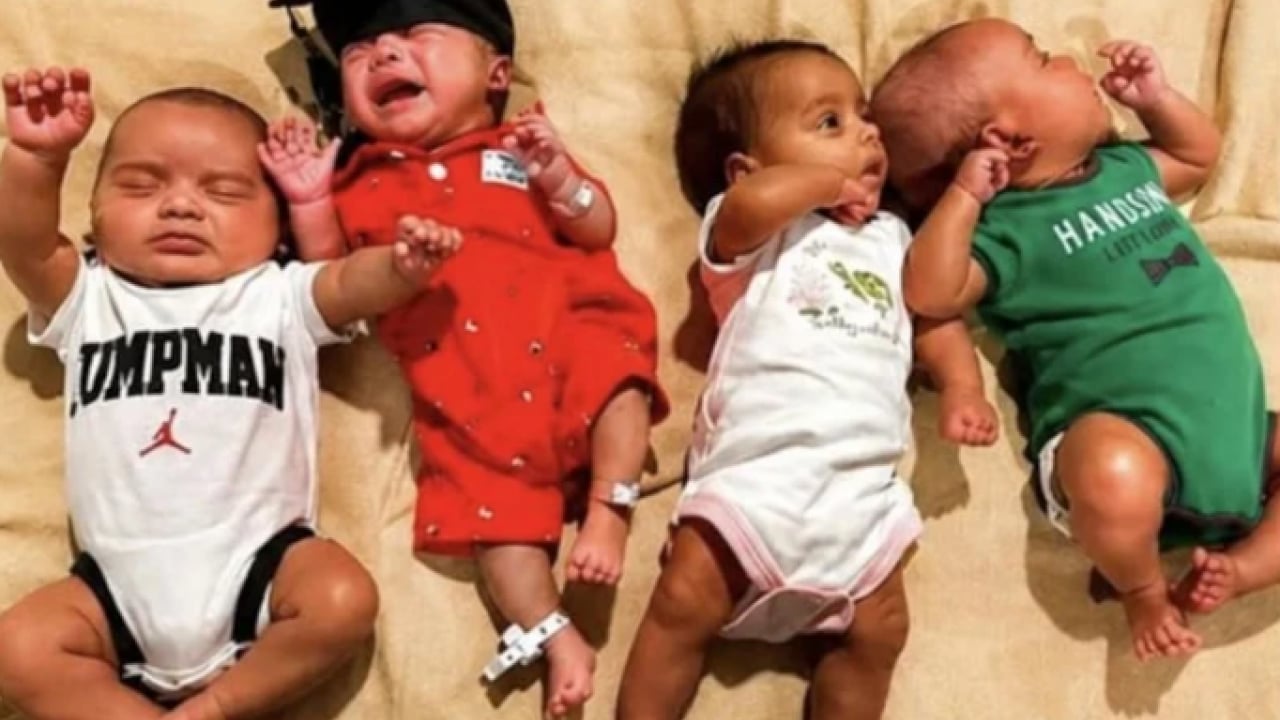 Foto - Avusturalya'daki doğum gündem oldu! 15 milyonda bir görülüyor!