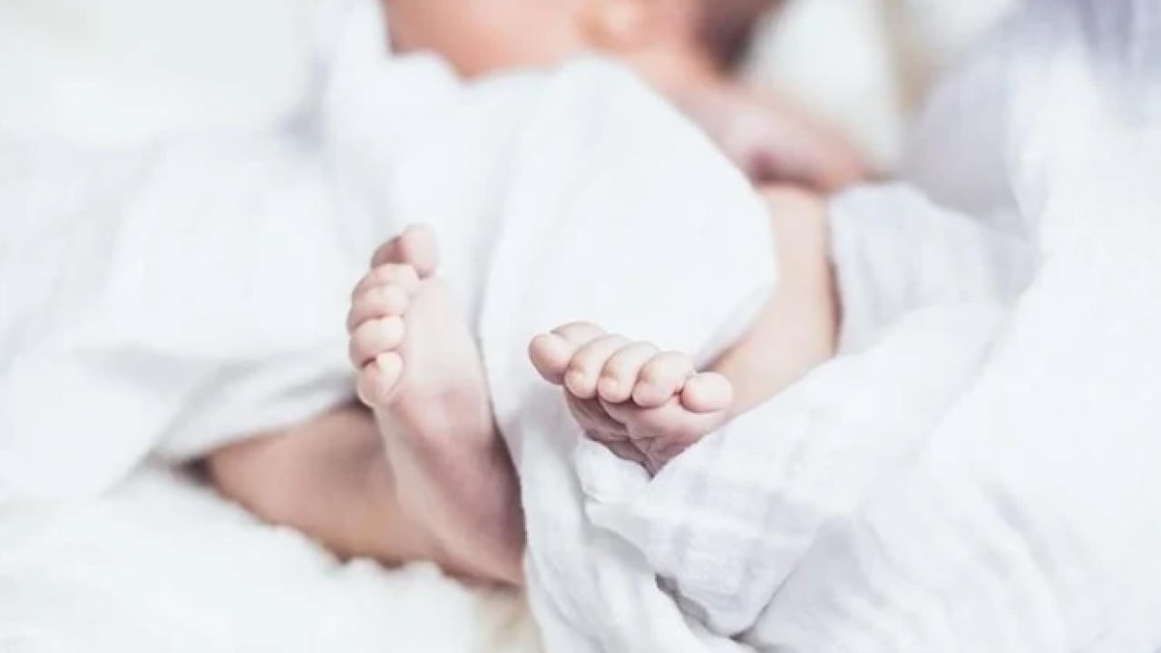 Foto - Avusturalya'daki doğum gündem oldu! 15 milyonda bir görülüyor!