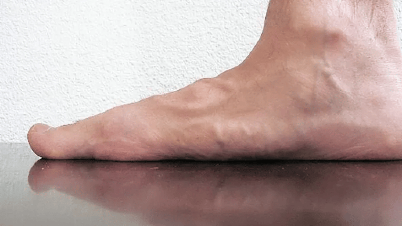 Foto - Ayak sağlığı için ayağa uygun olan ayakkabı: Düz tabanlı ayakkabılar! Spor ayakkabı satın almaktan vazgeçtiler!