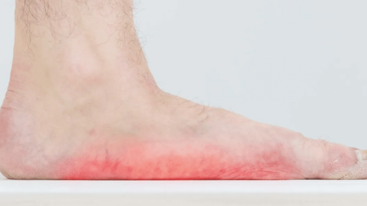 Foto - Ayak sağlığı için ayağa uygun olan ayakkabı: Düz tabanlı ayakkabılar! Spor ayakkabı satın almaktan vazgeçtiler!