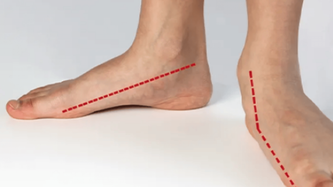 Foto - Ayak sağlığı için ayağa uygun olan ayakkabı: Düz tabanlı ayakkabılar! Spor ayakkabı satın almaktan vazgeçtiler!