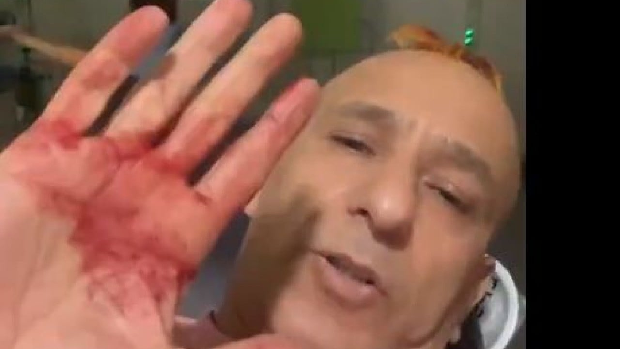 Foto - 'Bana bir şey yapamazsın' diyordu: Sedat Peker'e hakaret eden isimden korkunç haber geldi