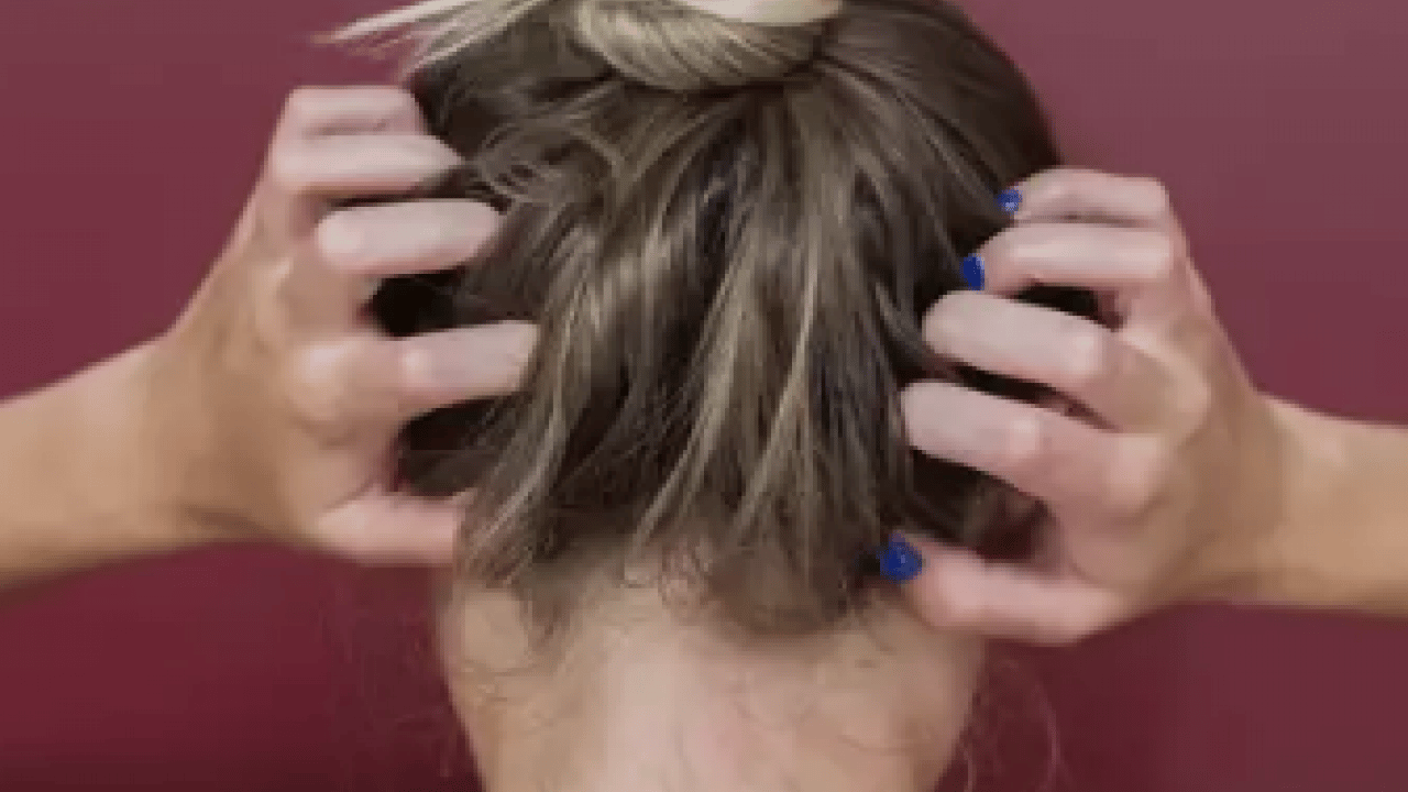 Foto - Bana uğramaz demeyin! Egzama nedir, nasıl oluşur ve nasıl geçer? Tek tek bunları not almalısınız...