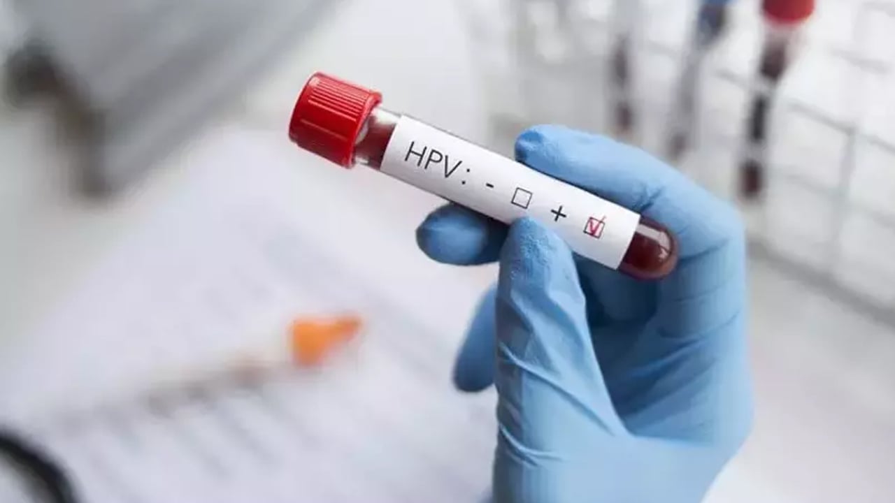 Foto - Baş-boyun kanserlerinde en büyük tehlike korkuttu! Doktor yanıt verdi: 100'den fazla HPV virüsü var