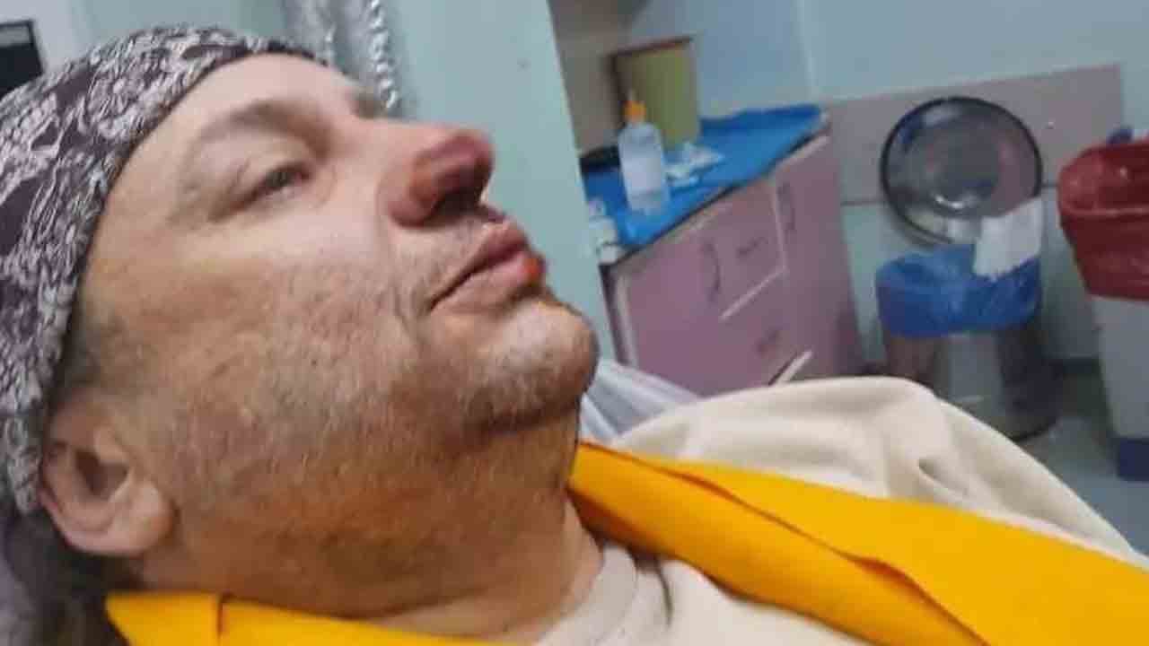 Foto - Başıboş köpeğin saldırdığı şarkıcıdan kötü haber: Entübe edildi, durumu kritik