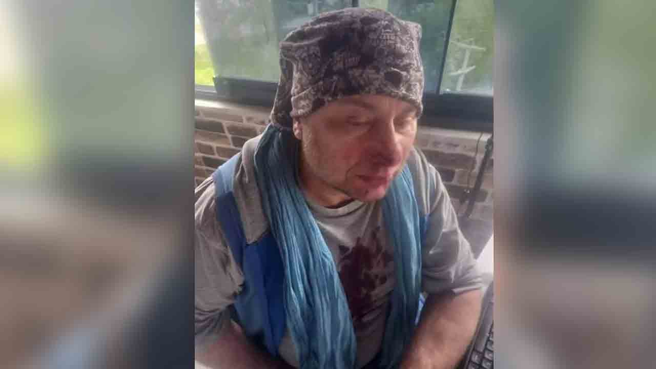 Foto - Başıboş köpeğin saldırdığı şarkıcıdan kötü haber: Entübe edildi, durumu kritik