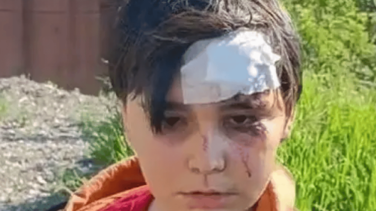 Başıboş köpekler can yakmaya devam ediyor! 2 çocuk saldırıya uğradı!