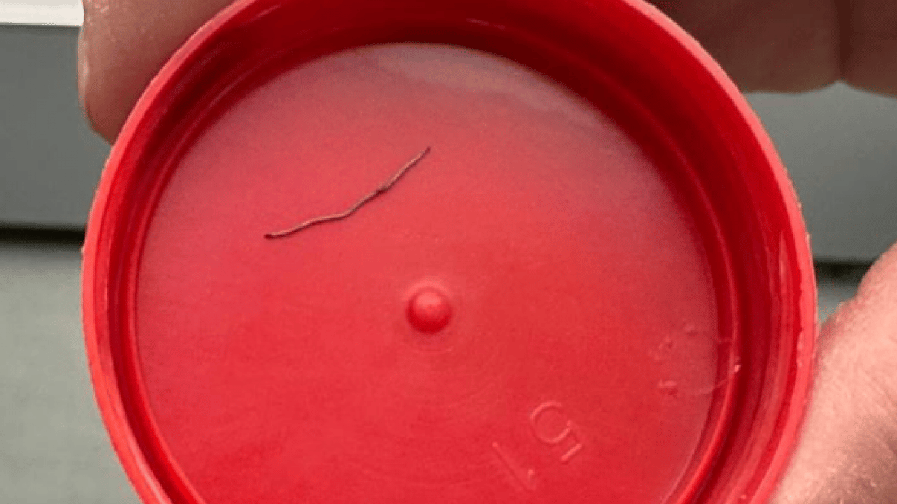 Foto - Bebeğin sırtından çıkan şey şoke etti