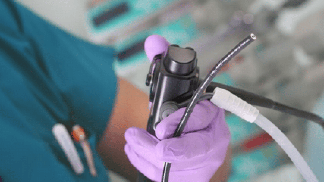 Foto - Beklenmedik gelişmelere hazır olmalısınız! Erken teşhisin anahtarı endoskopi ve kolonoskopi... Umut vadediyor