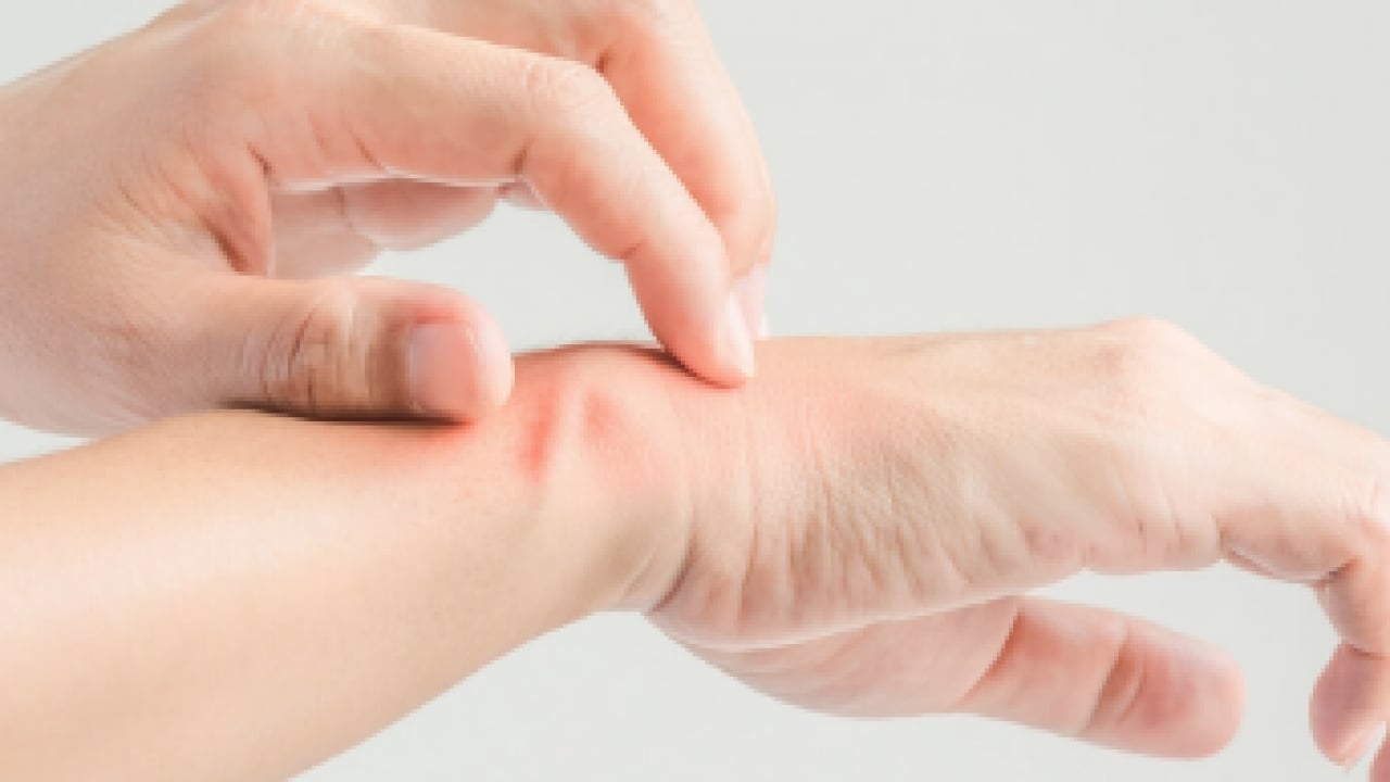 Foto - Belli oldu! Bu yöntemle kaşıntı tarih olacak! Şok eden rahatsızlık sona erecek...