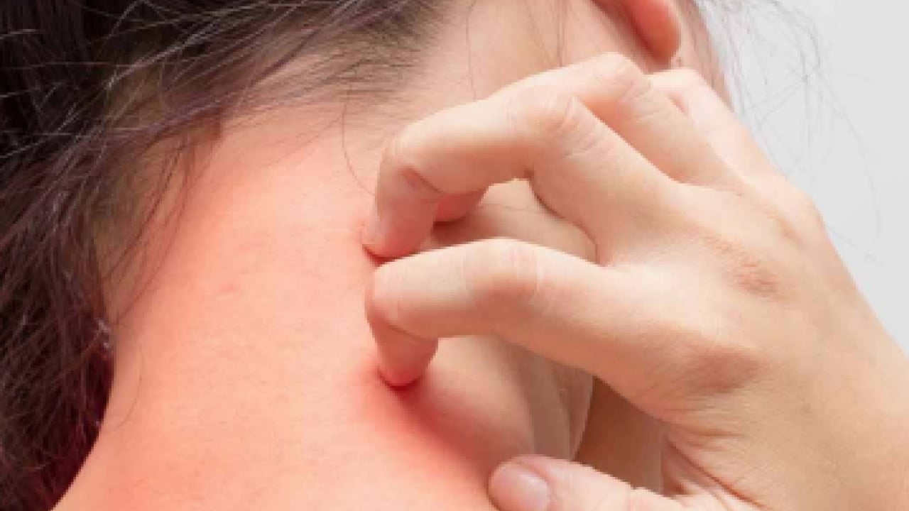 Foto - Belli oldu! Bu yöntemle kaşıntı tarih olacak! Şok eden rahatsızlık sona erecek...