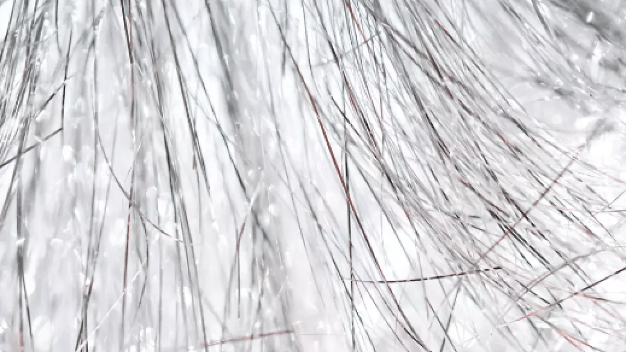 Foto - Belli oldu! Gençlerin saçı neden beyazlar? Ya siz de bu sorunu yaşıyorsanız... 