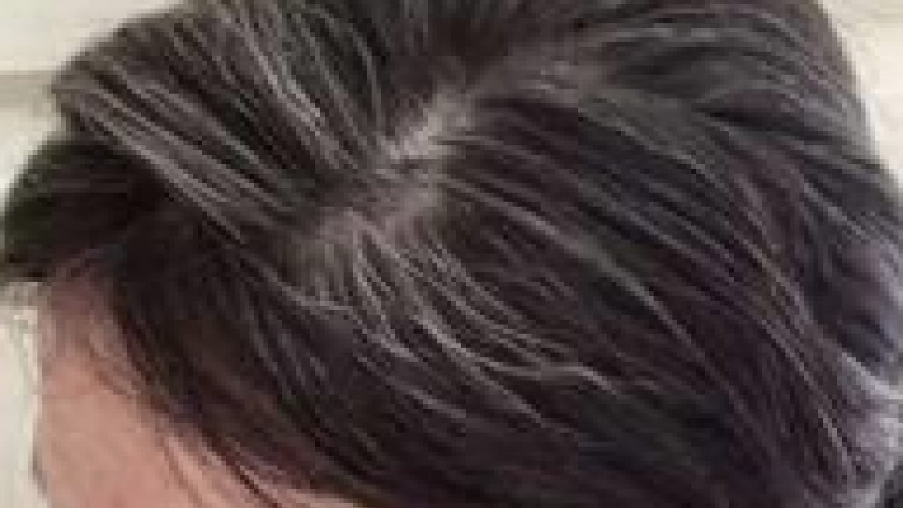 Foto - Belli oldu! Gençlerin saçı neden beyazlar? Ya siz de bu sorunu yaşıyorsanız... 