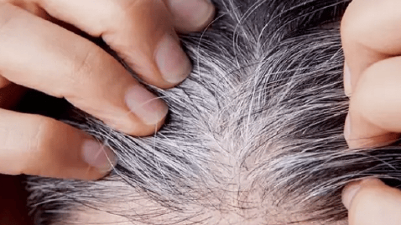 Belli oldu! Gençlerin saçı neden beyazlar? Ya siz de bu sorunu yaşıyorsanız... 