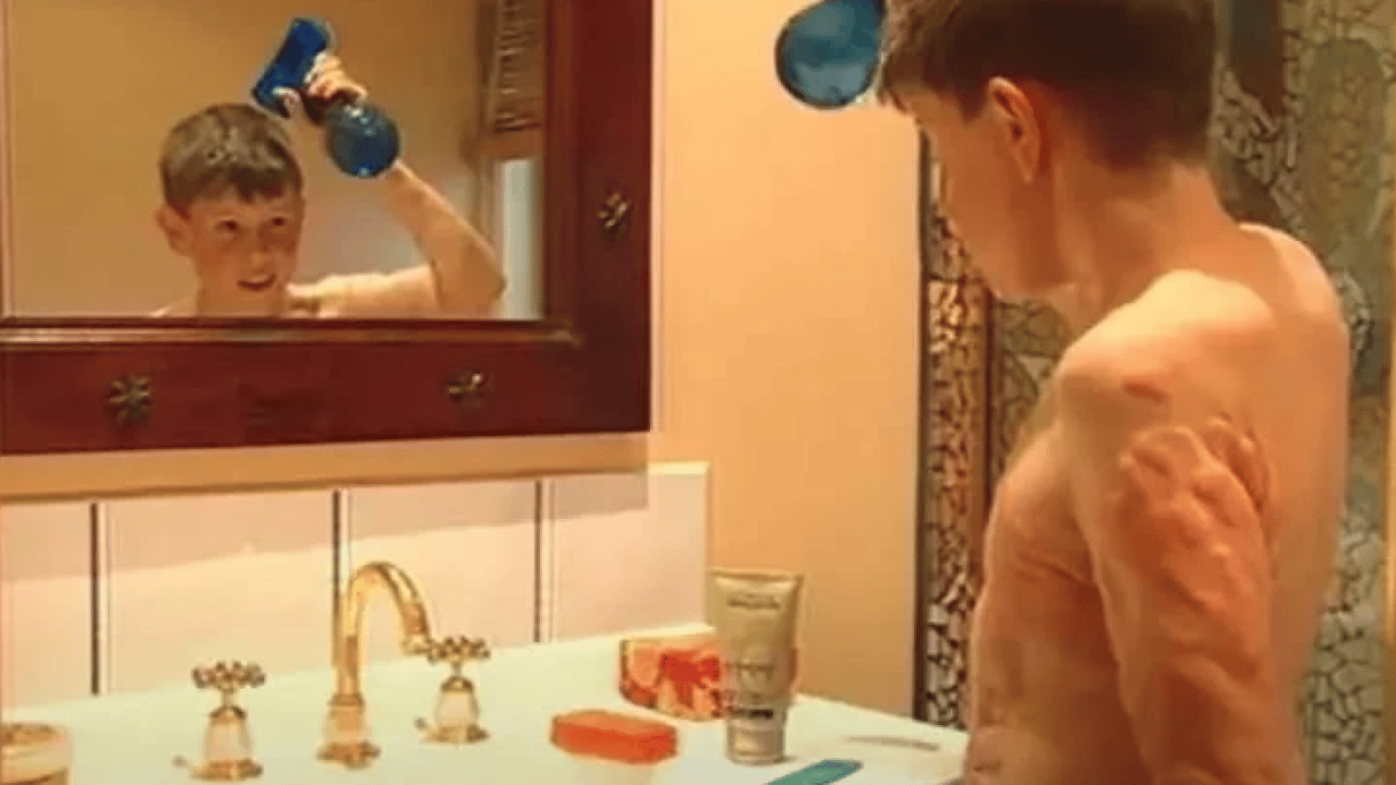 Foto - Benjamin Button filmi gerçek oldu: Yaşlı doğan adamın son hali şaşırttı!