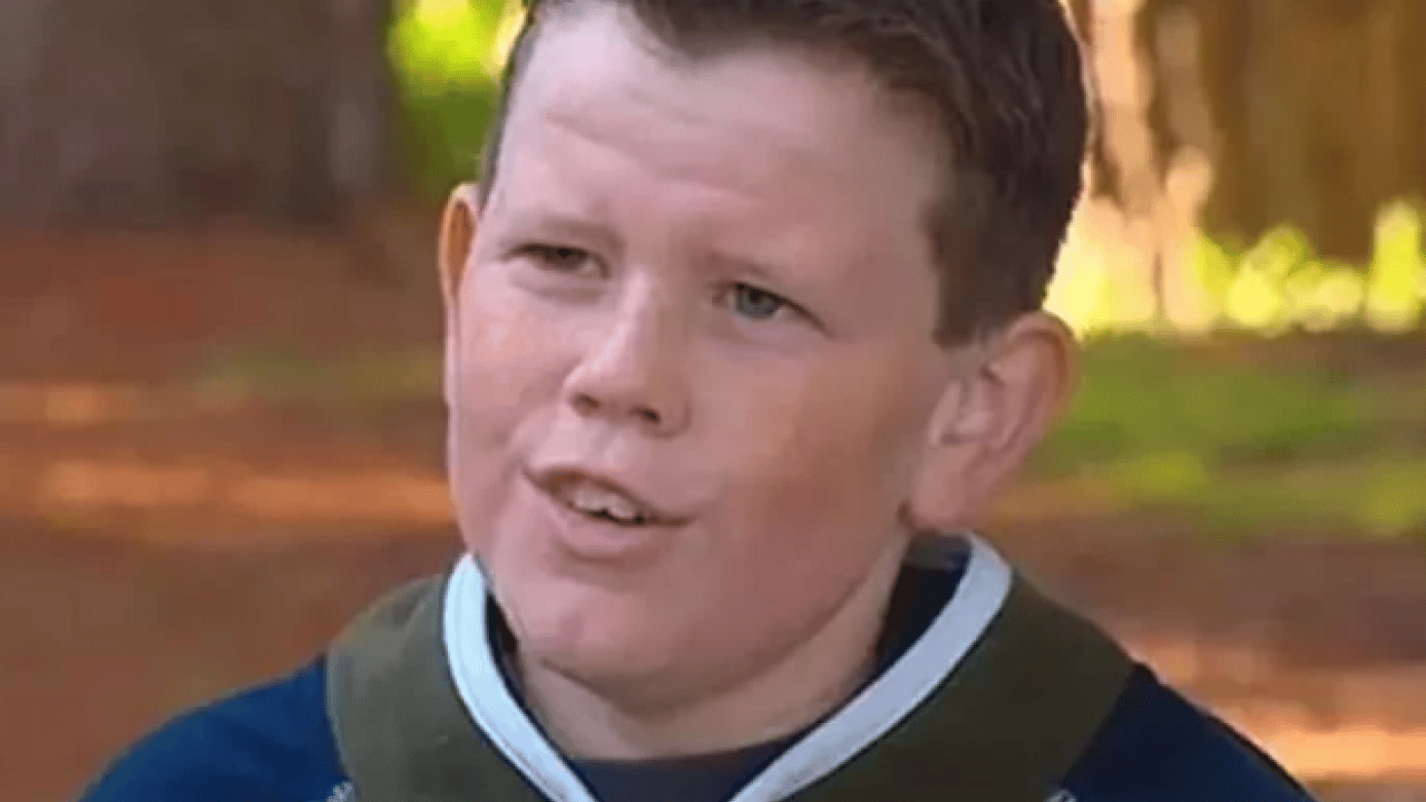 Foto - Benjamin Button filmi gerçek oldu: Yaşlı doğan adamın son hali şaşırttı!