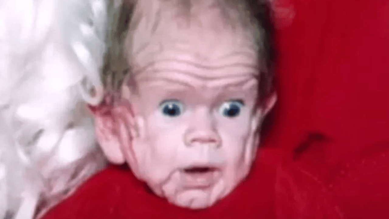 Foto - Benjamin Button filmi gerçek oldu: Yaşlı doğan adamın son hali şaşırttı!