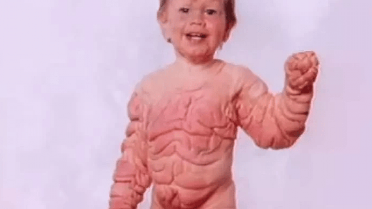 Foto - Benjamin Button filmi gerçek oldu: Yaşlı doğan adamın son hali şaşırttı!