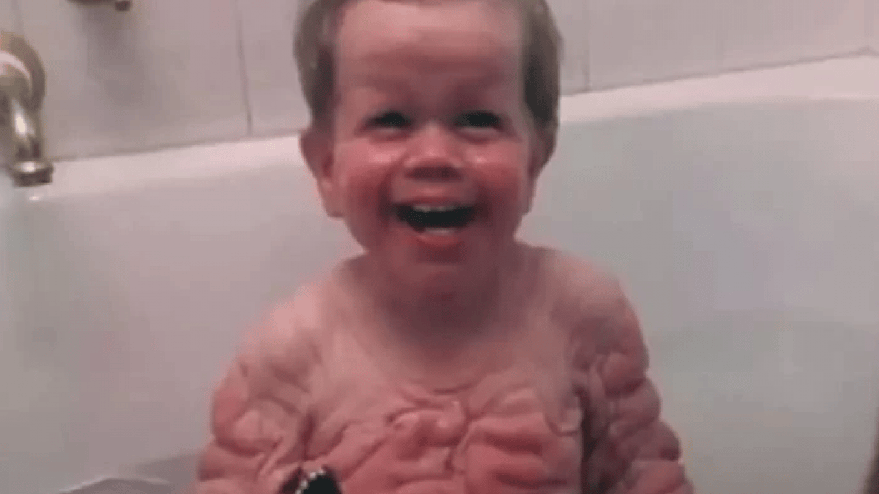 Foto - Benjamin Button filmi gerçek oldu: Yaşlı doğan adamın son hali şaşırttı!