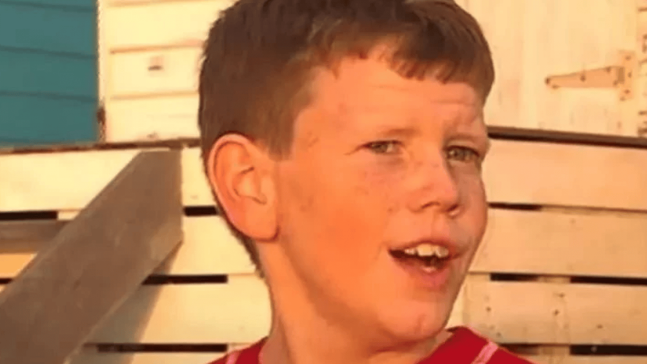 Foto - Benjamin Button filmi gerçek oldu: Yaşlı doğan adamın son hali şaşırttı!