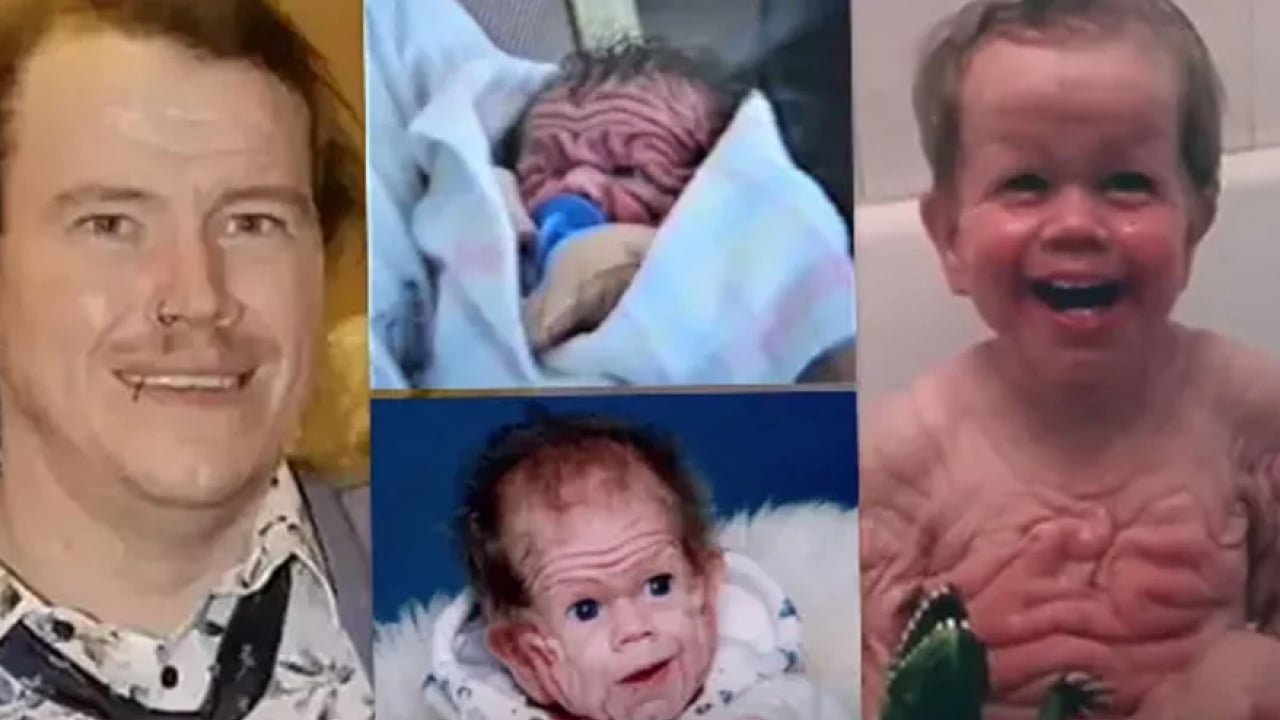 Benjamin Button filmi gerçek oldu: Yaşlı doğan adamın son hali şaşırttı!